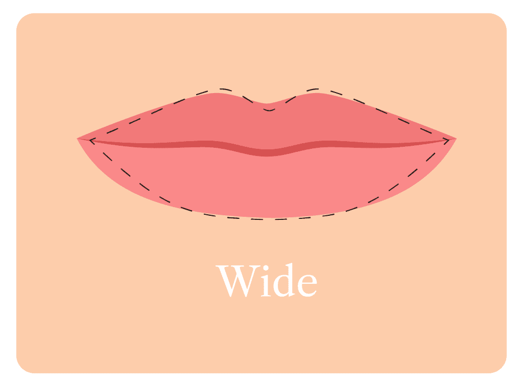 c type lips meaning Lip Filler Shape Guide: How Fillers Can Help You Achieve The Lips You Want  - Carolina Facial Plastics